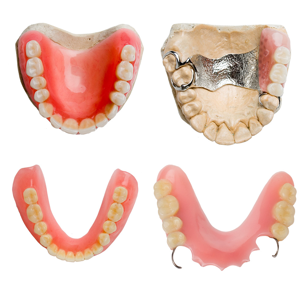 Dentures - Partial Dentures & Complete Dentures