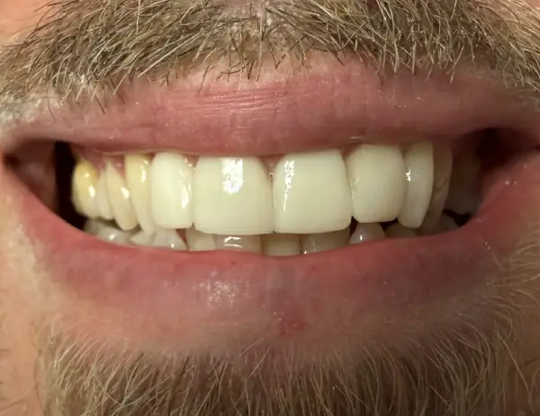 cosmetic after