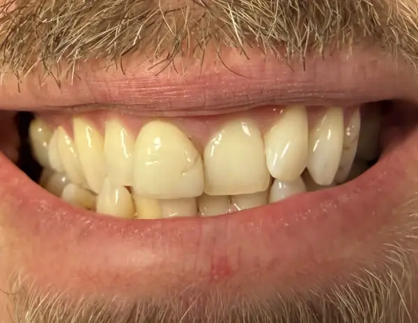 cosmetic before